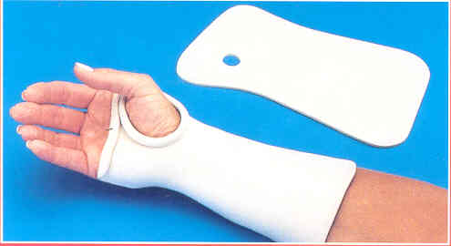 Splints For Hands. the hand Canthis splint